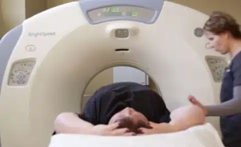 Lung Cancer Screening: The Life-saving CT Scan