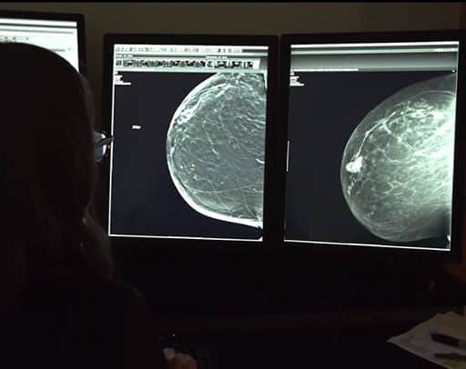 What’s The Best Cancer Screening For Women With Dense Breasts? - RAYUS ...