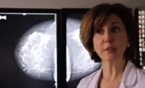 Choosing the Best Breast Screening: 2D vs 3D Mammogram/Tomosynthesis