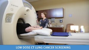 Low Does CT Lung Cancer Screening