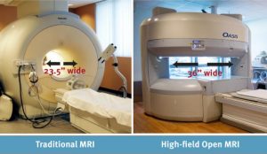 Traditional vs High-field open MRI