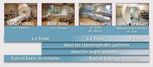 4 Types of MRI machines