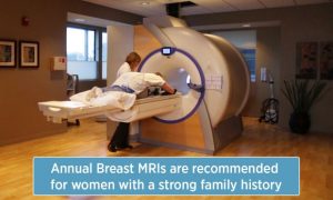 Annual Breast MRIs are recommended for women with a strong family history
