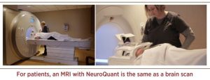 MRI with NeuroQuant