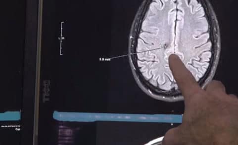 RAYUS Radiology gets ahead of brain injuries with advanced concussion protocol