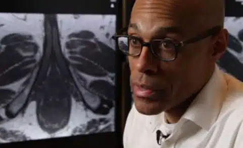 How MRI-Guided Ultrasound Can Help Detect Prostate Cancer