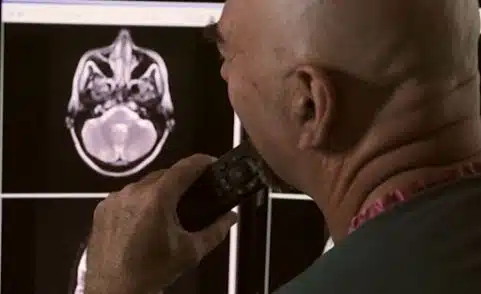 radiologist looking at an mri scan