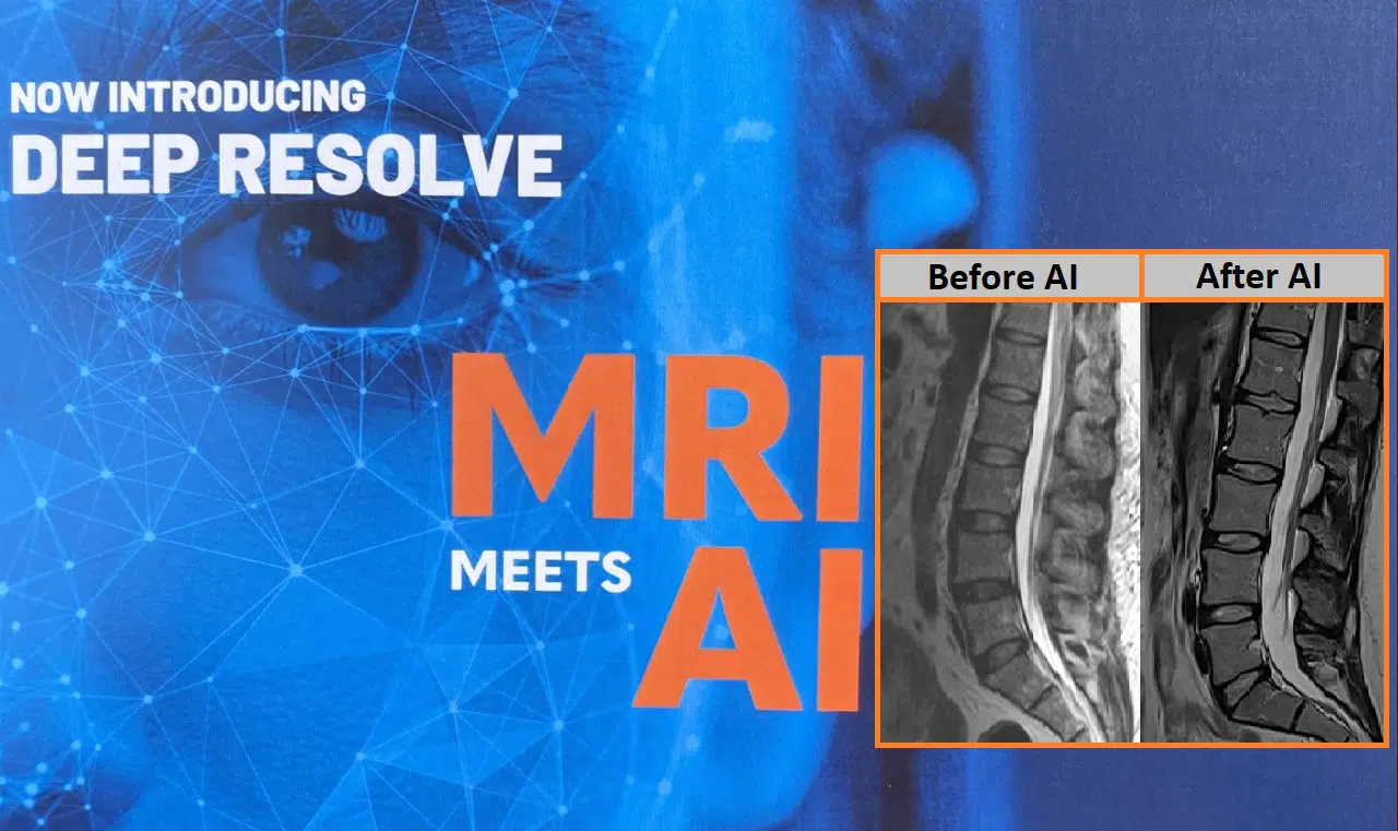 MRI meets AI image shows scans before and after AI