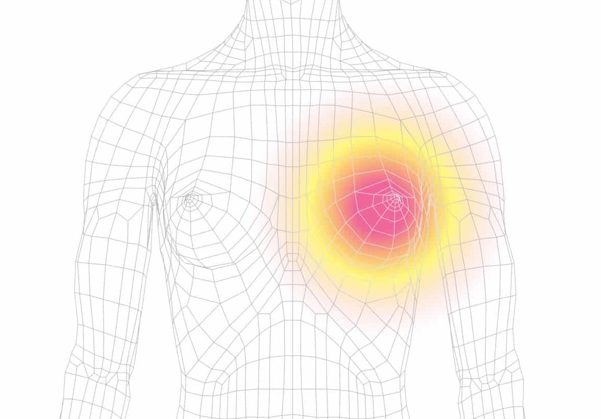 Rayus Contrast Form Managing Your Breast Cancer Risk - RAYUS Radiology